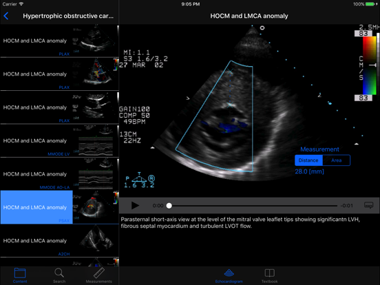 CARDIO3®Echocardiography HDのおすすめ画像2