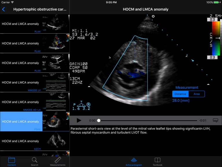 【图】CARDIO3®Echocardiography HD(截图2)