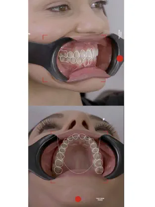 Imágen 6 Dental Shooting iphone