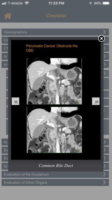 How to cancel & delete CTisus Pancreatic Mass Checklist from iphone & ipad 4