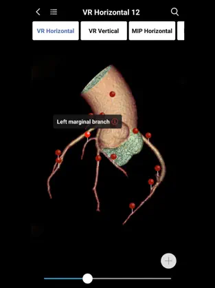Captura de Pantalla 8 MedImaging-Radiology Made Easy iphone