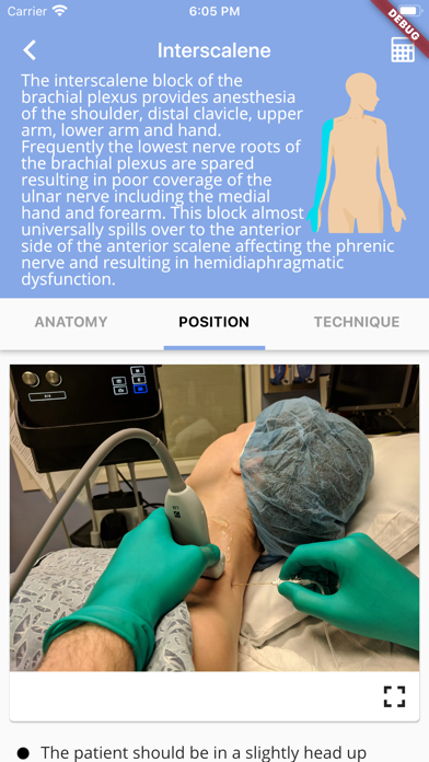 Regional Anesthesia Reference screenshot 4