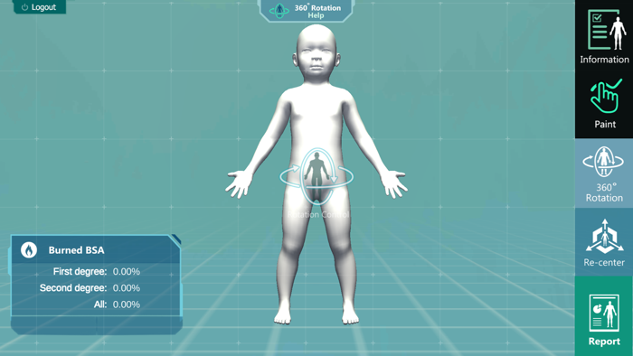 3D PED Burn Resuscitation