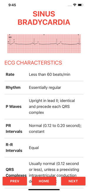 ECG FlashCards 2(圖3)-速報App