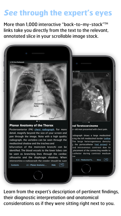 How to cancel & delete Radiology - Thoracic Imaging from iphone & ipad 4