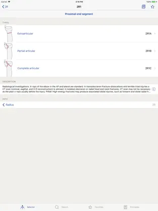 Captura 2 AO/OTA Fracture Classification iphone