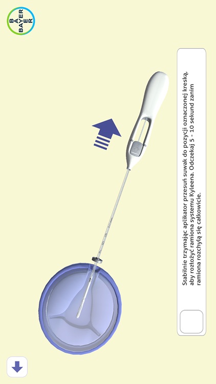 IUS Insertion screenshot-6