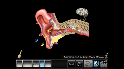 How to cancel & delete Otitis Media Disorders from iphone & ipad 3