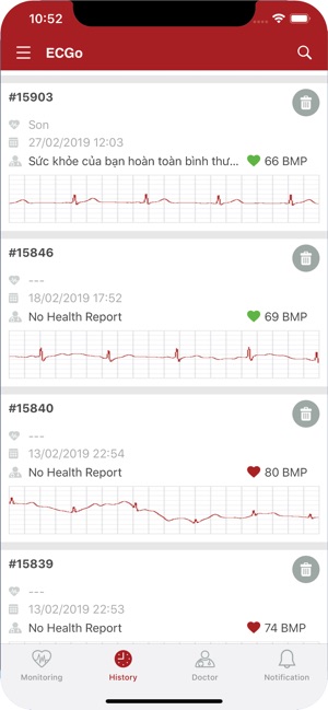 ECGo - ECG on the go(圖2)-速報App