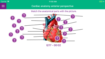 Cardiac Surgery Basics screenshot 3