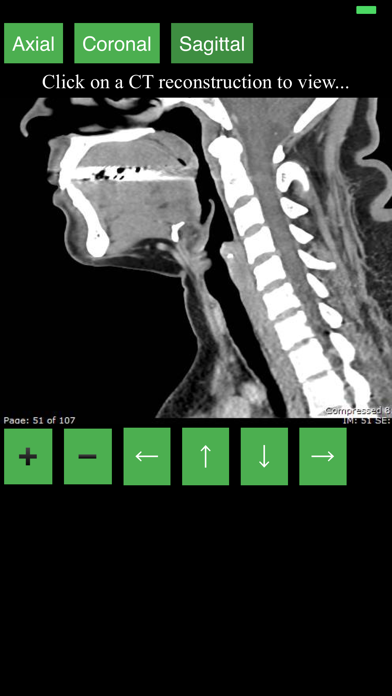 How to cancel & delete CT Neck from iphone & ipad 2