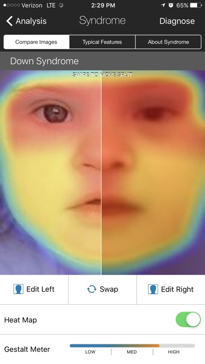 Face2Gene