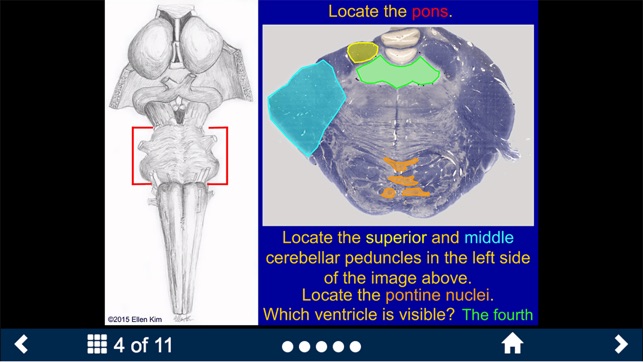 Neuroanatomy - SecondLook(圖5)-速報App