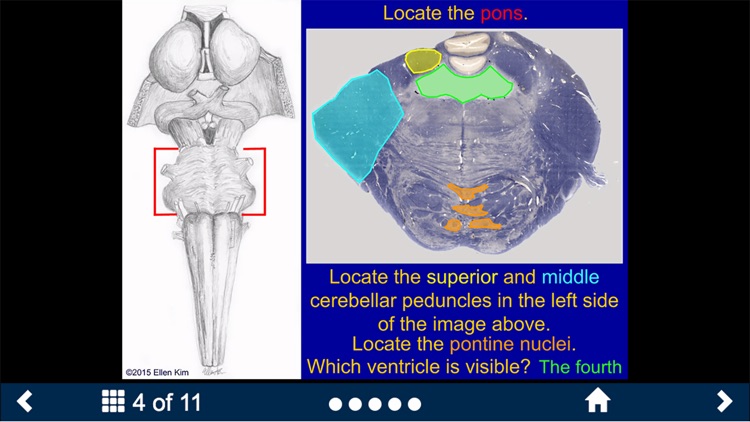 Neuroanatomy - SecondLook screenshot-4
