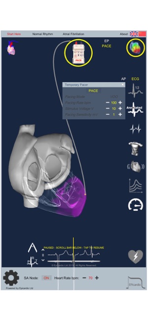 Intelligent Heart Sim AFib(圖4)-速報App