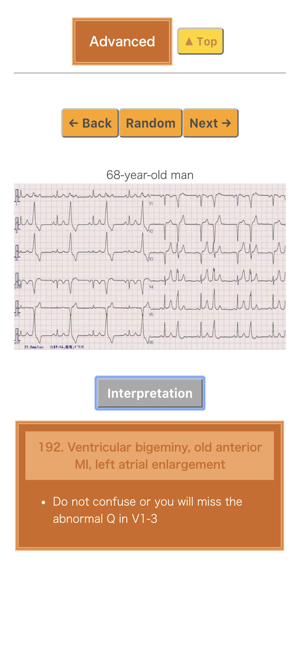 Pocket ECG(圖4)-速報App