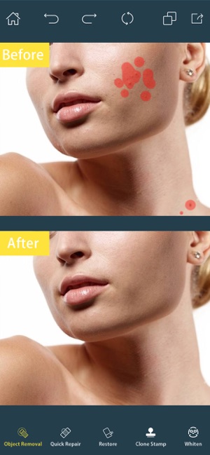 Photo Retouch- Blemish Remover(圖3)-速報App