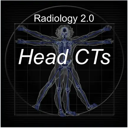 Radiology 2.0: Head CTs Читы