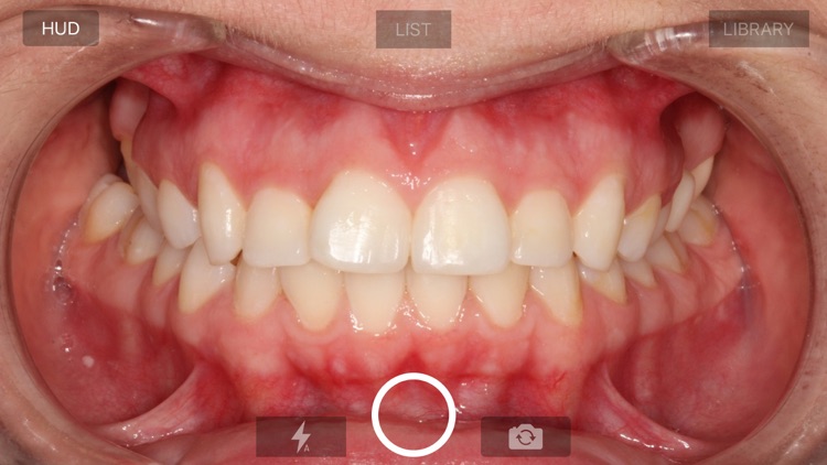 IOC Snapshot Camera screenshot-3