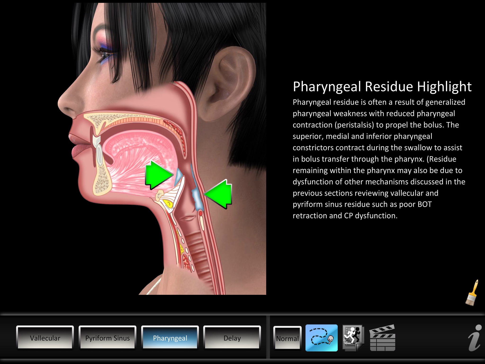 Residue Disorders screenshot 2