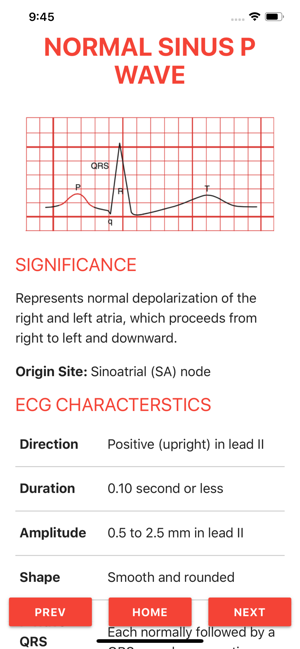 ECG FlashCards 2