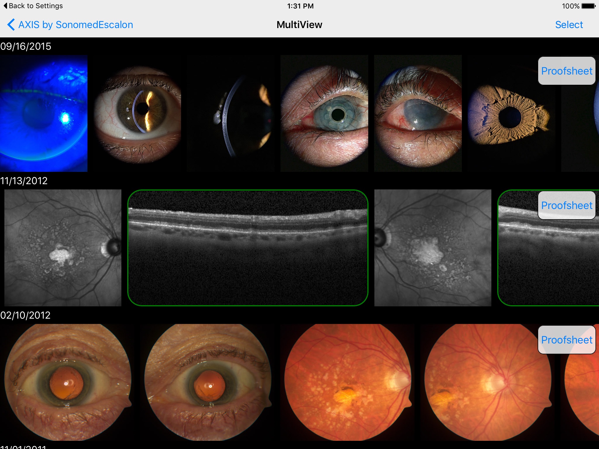 SonomedEscalon Axis screenshot 2