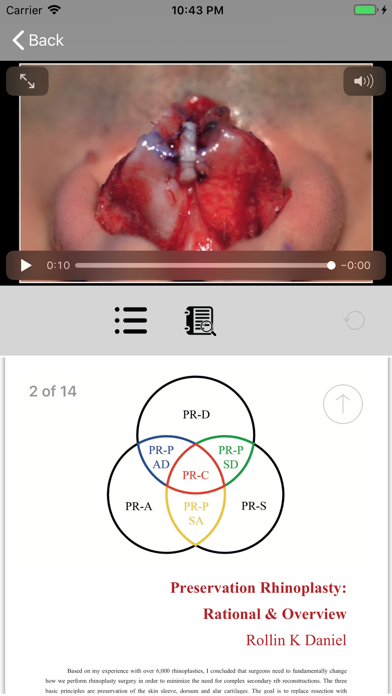 How to cancel & delete Preservation Rhinoplasty from iphone & ipad 3