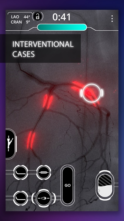 Cardio Ex screenshot-0