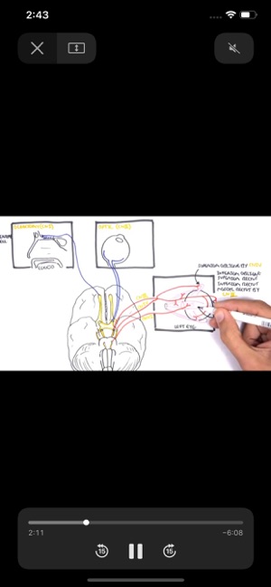 Cranial Nerves Plus(圖5)-速報App