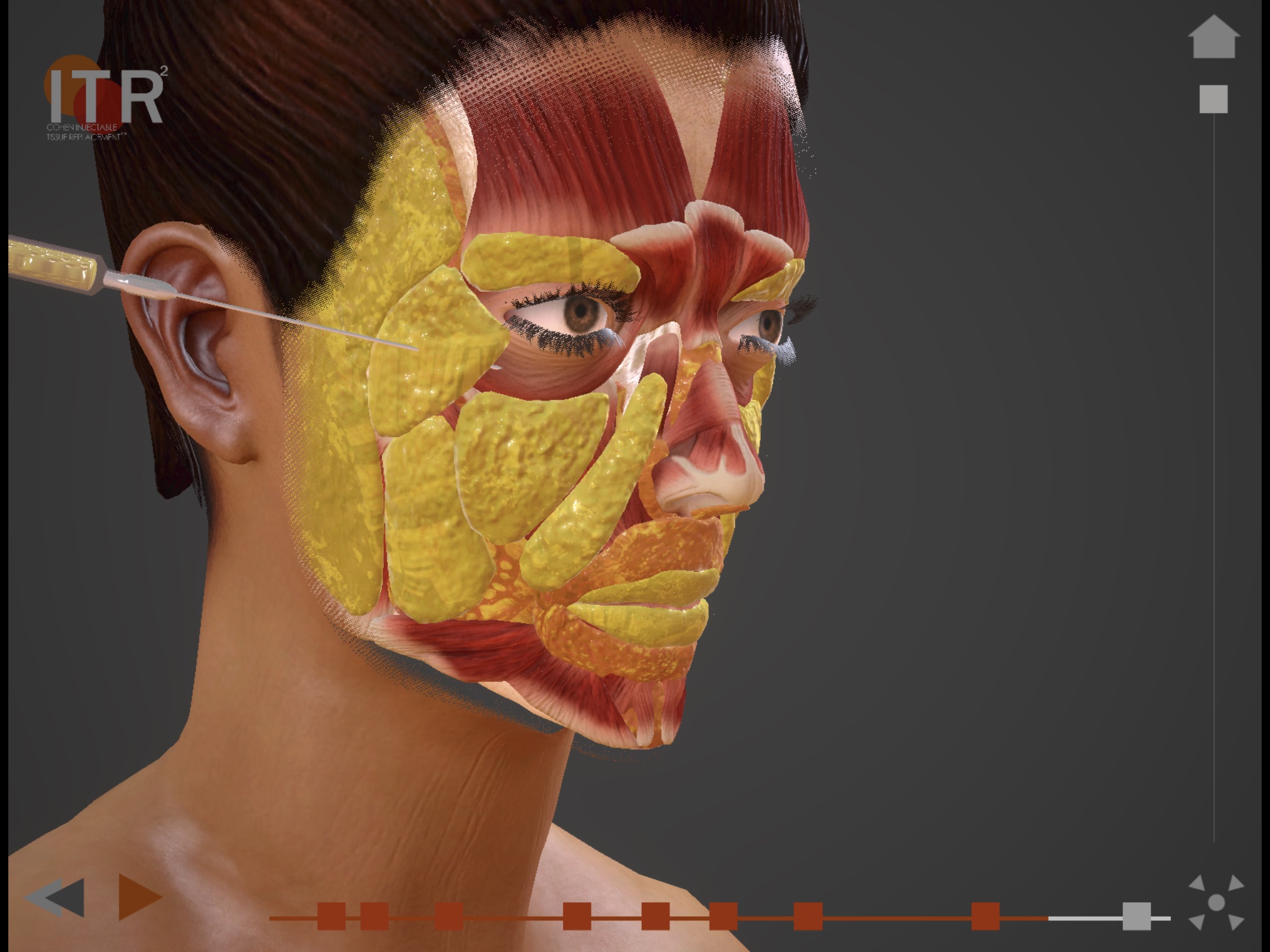 Facial Fat Grafting screenshot 3