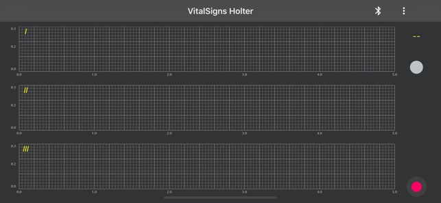 VitalSign Holter(圖2)-速報App