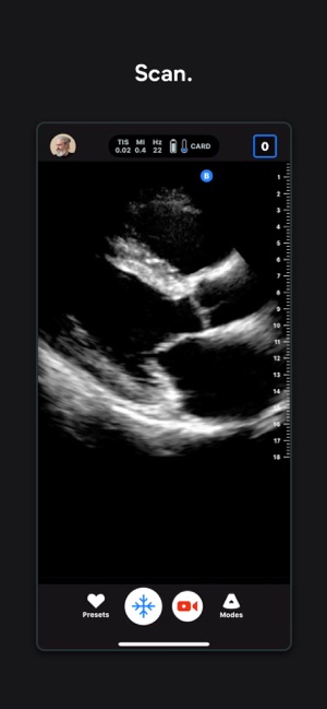 Butterfly iQ — Ultrasound(圖2)-速報App