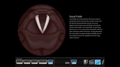 How to cancel & delete Vocal Pathology: Neurological from iphone & ipad 4