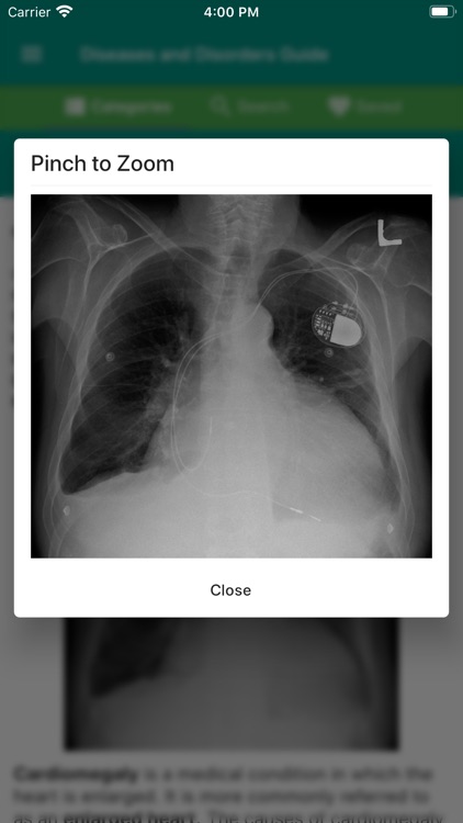 Diseases and Disorders Guide screenshot-3