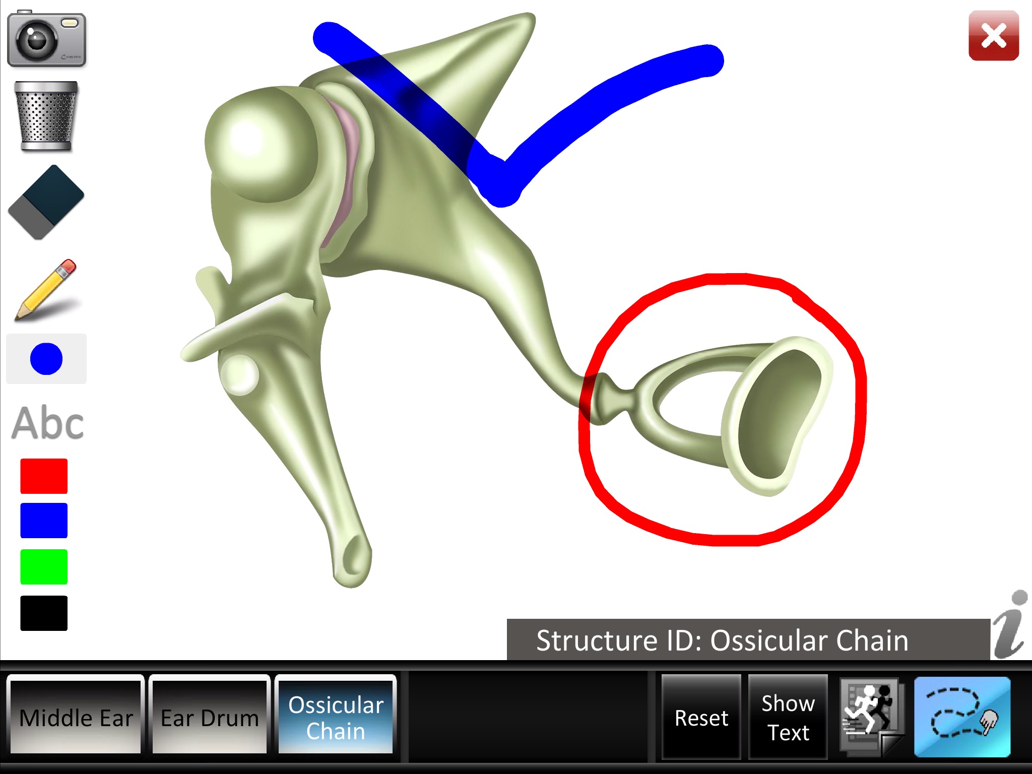 Middle Ear ID screenshot 4