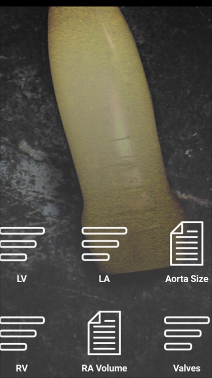Echocompanion screenshot-3