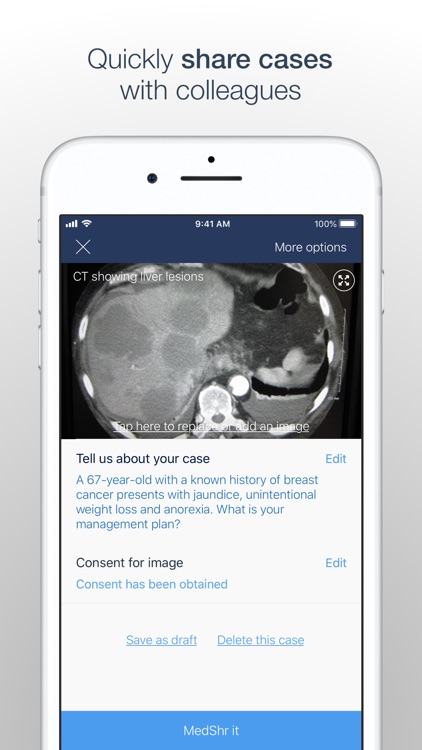 MedShr: Discuss Clinical Cases screenshot-3