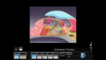 How to cancel & delete Ear Disorders: Inner from iphone & ipad 1