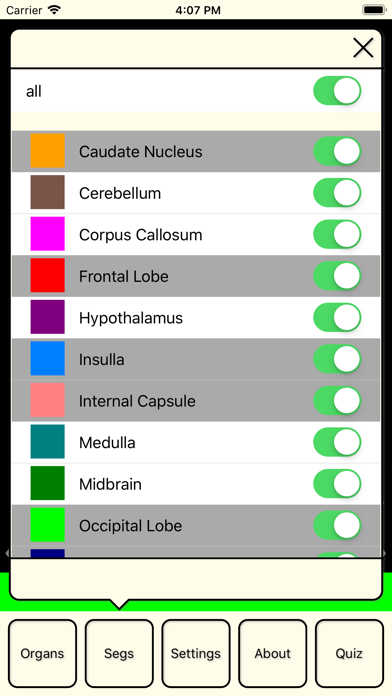 How to cancel & delete RadAnatomyLite from iphone & ipad 2