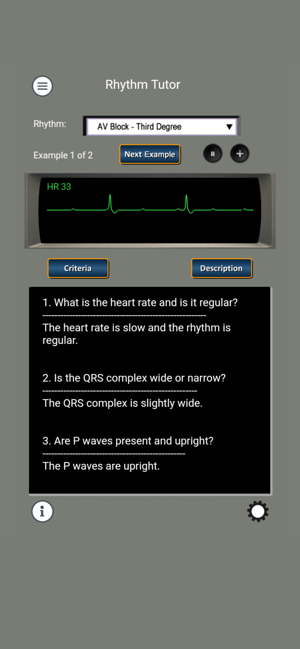 ECG Rhythms and ACLS Cases(圖3)-速報App