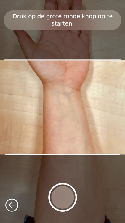 RadboudUMC WondGezond