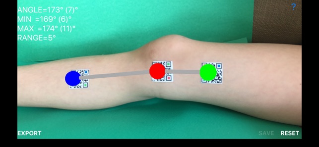 DynamicGoniometerAR(圖7)-速報App