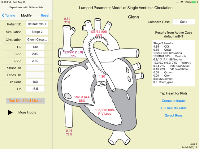 Single Ventricle Circulation(圖2)-速報App