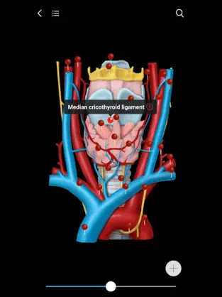 Captura 2 MedImaging-Radiology Made Easy iphone