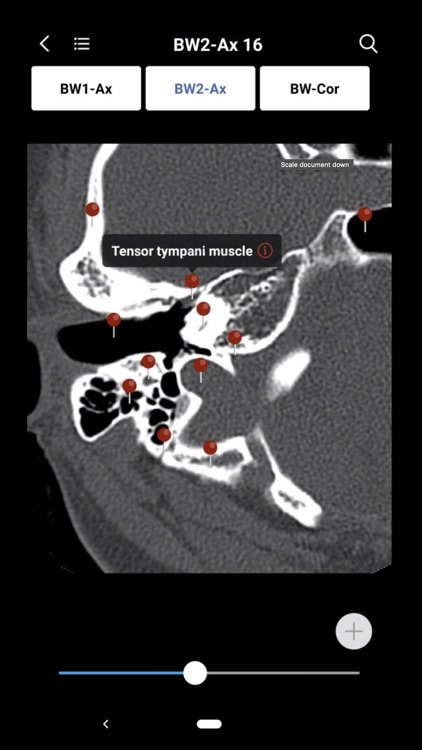 MedImaging-Radiology Made Easy screenshot-3