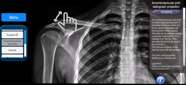 Anatomy and X-Ray Positioning(圖2)-速報App