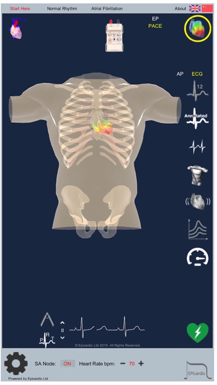 Intelligent Heart Sim AFib