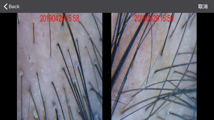 头皮毛发检测-新生活 screenshot-5