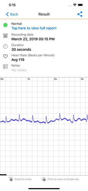 ECG Check(圖2)-速報App