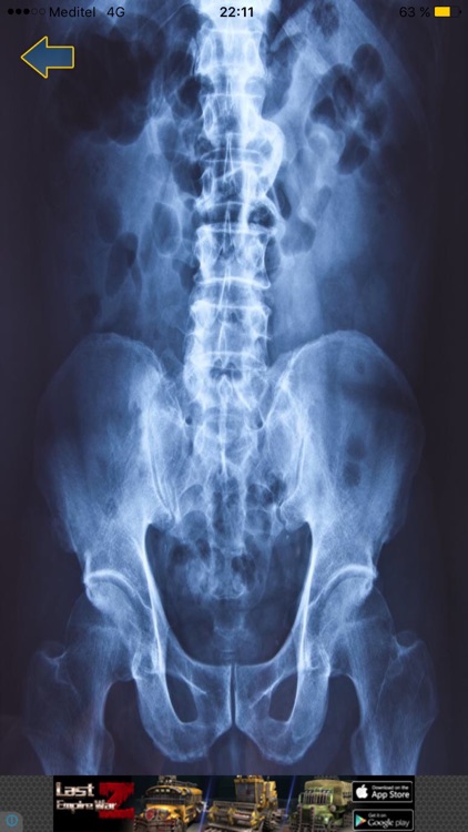 X-ray Scanner body screenshot-3